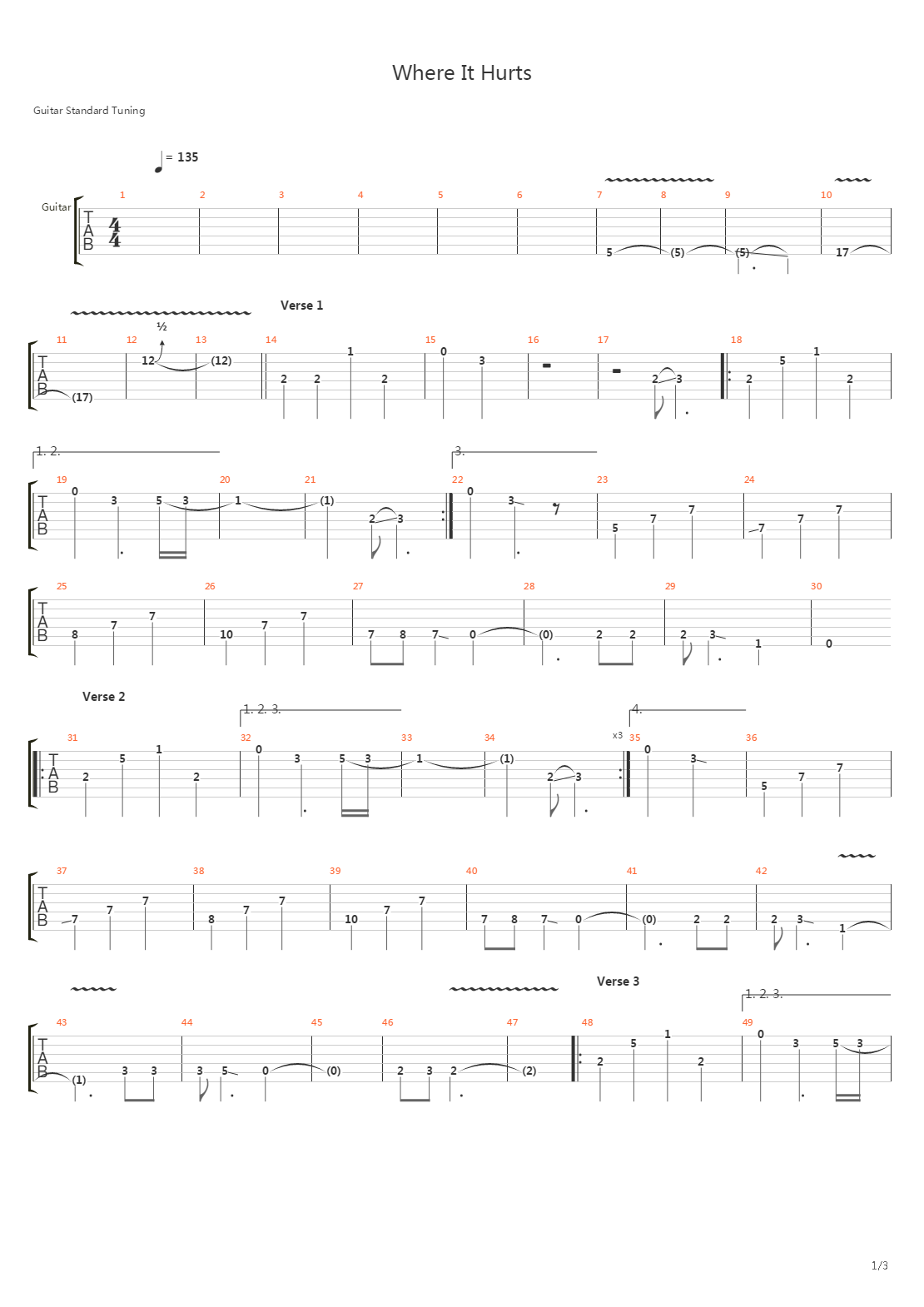 Where It Hurts吉他谱